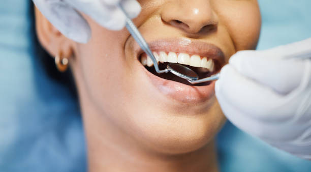 Best Emergency Tooth Extraction in Peculiar, MO