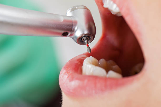 Best Pediatric Emergency Dentist in Peculiar, MO